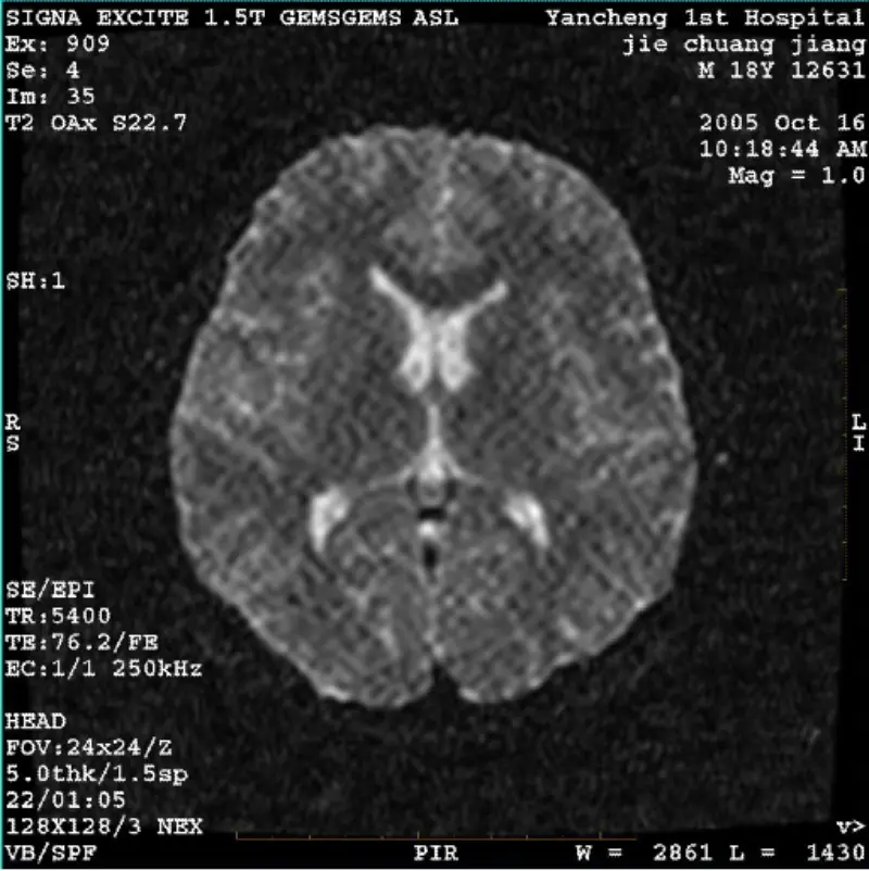ARTIFACT WI/フィエスタイメージ ホワイトピクセル