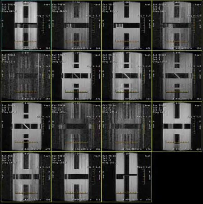 FSE および GRE アーティファクト